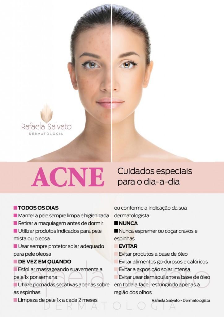 acne infograma rafaela salvato dermatologia