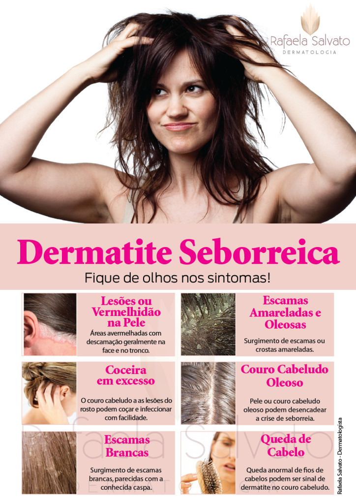 dermatite seborreica rafaela salvato dermatologia