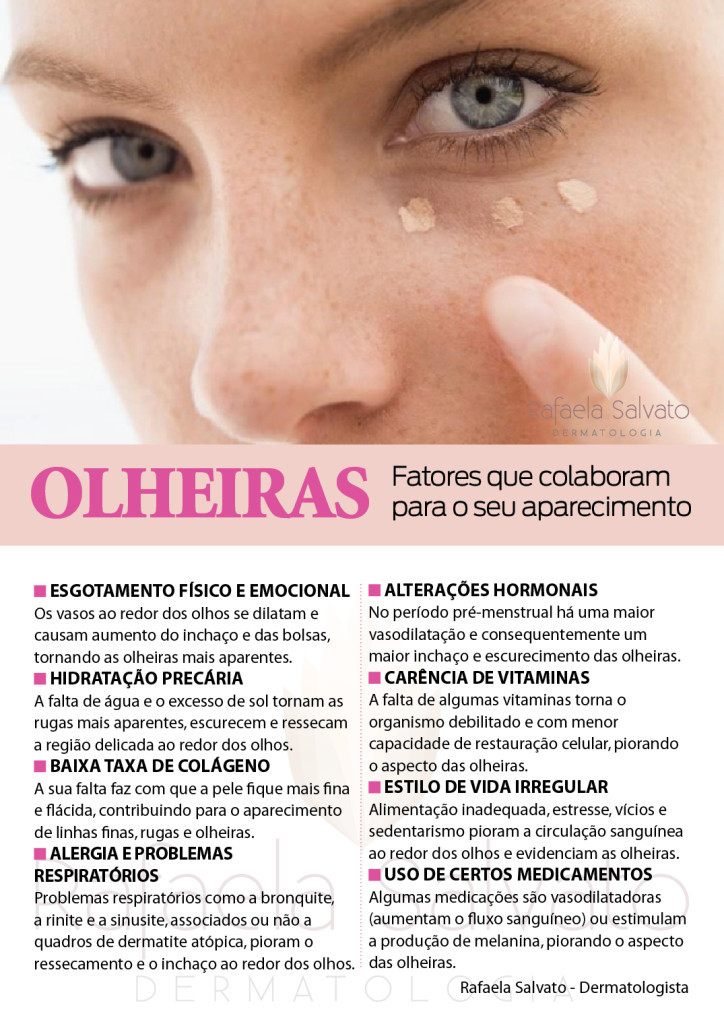 olheiras infografico Rafaela Salvato Dermatologia