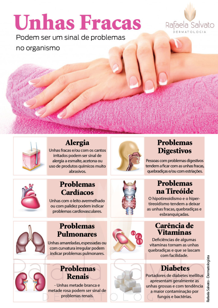 unhas fracas