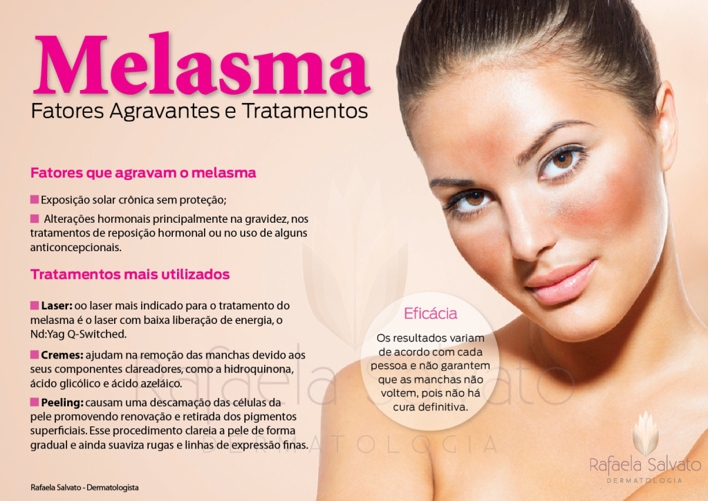 melasma - Florianopolis Dra. Raafela Salvato