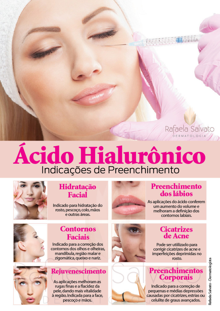 Preenchimento Ácido Hialurônico infográfico florianopolis